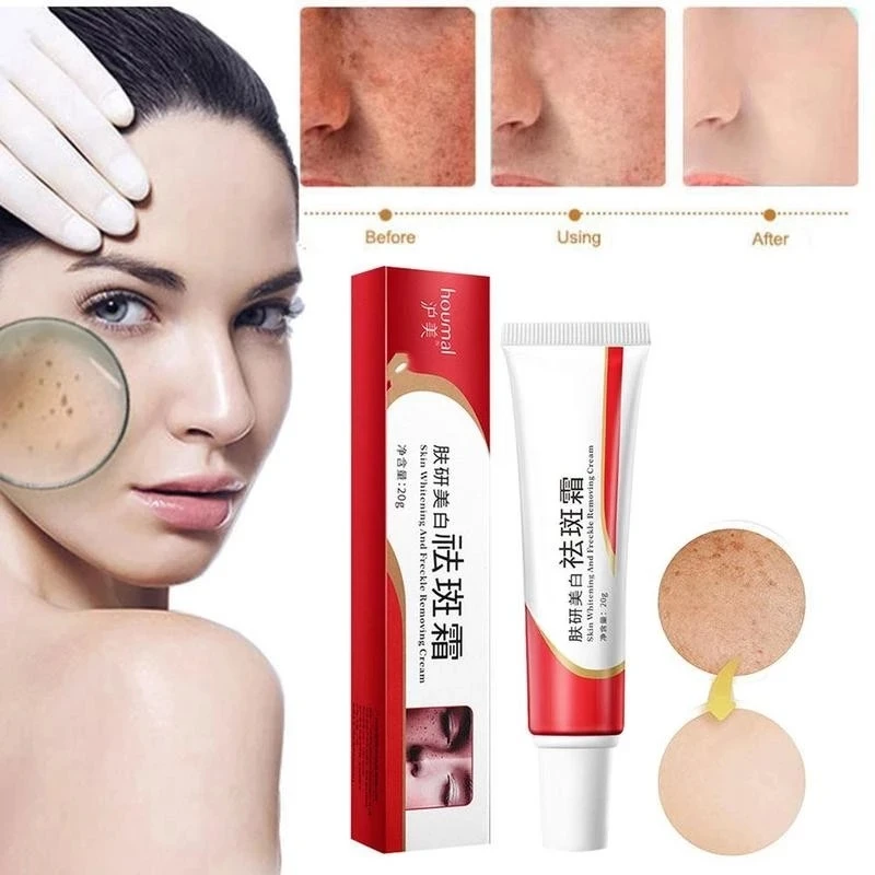 

20g Whitening Freckle Cream Remove Melasma Acne Spot Pigment Melanin Dark Spots Pigmentation Moisturizing Gel Skin Care