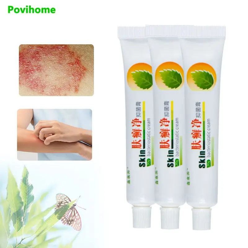 3 шт. антибактериальный крем для лечения псориаза экзема | Красота и здоровье