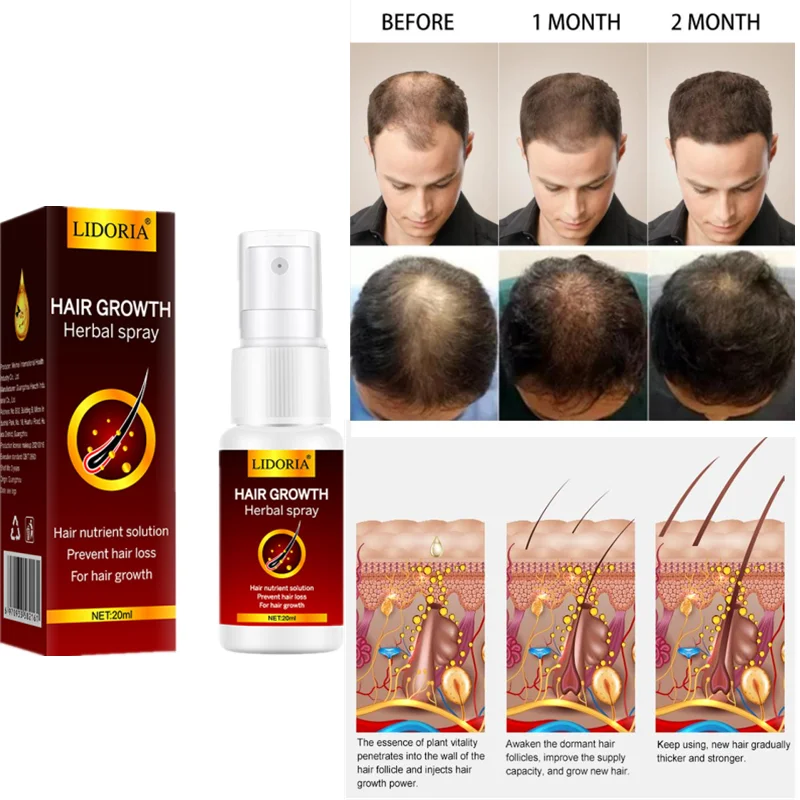 

Ginger Hair Spray Serum Anti-hair Loss Product Rapid Growth Prevents Dry and Frizzy Hair Damage and Thinning Repair Care