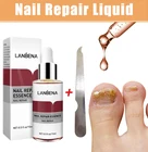 Средство для лечения Ногтей от грибков, жидкая питательная сыворотка для восстановления пальцев и ног, для удаления онихомикоза, грибка, Уход за ногтями 12 мл TSLM1