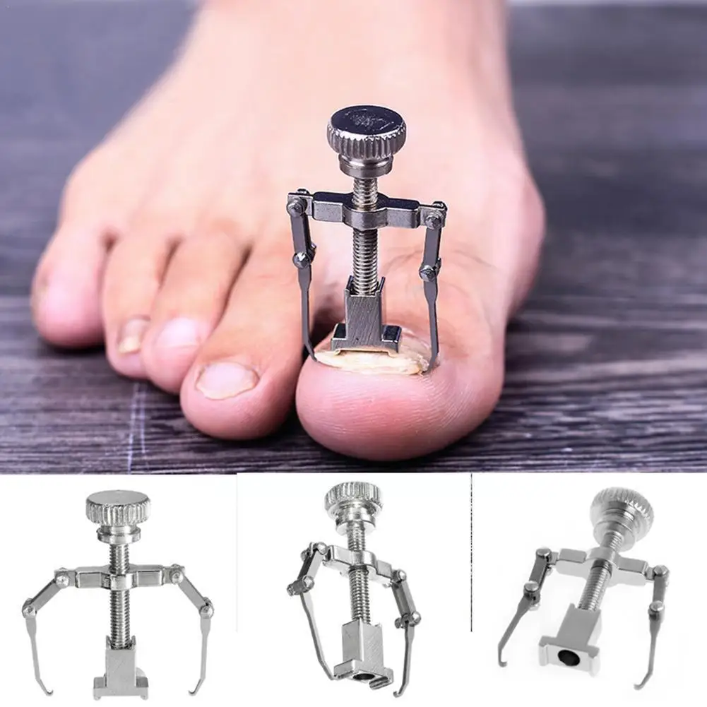 

Ingrown Toenail Correction Tool Pedicure Foot Nail Steel Pedicure Care Treatment Tool Correction Pedicure Tools Onyxis W4V8