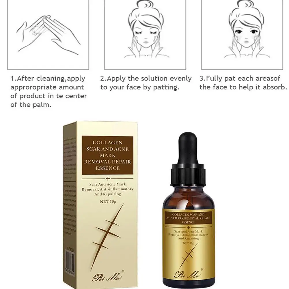 

30ml Women Collagen Imprint Repair Fluid Acne Scar Removal Cream Essence Pimples Stretch Marks Remove Face Serum Skin Care