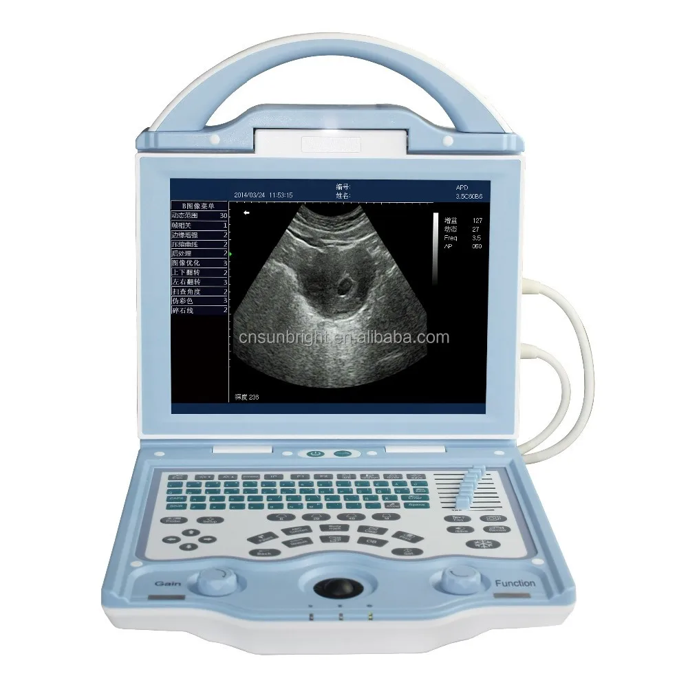

CE Approved Echocardiograph Medical Ultrasound Equipment