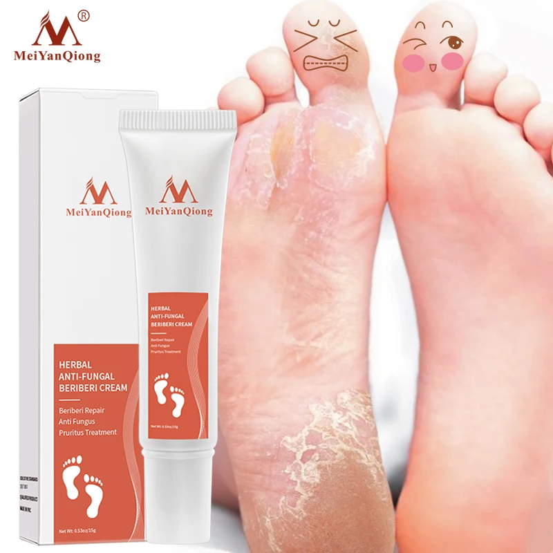 

Herbal Anti Fungal Foot Cream Relieve Itching Anti Crack Dryness Peeling Repair Foot Mask Removal Dead Skin Callus Feet Care 15g
