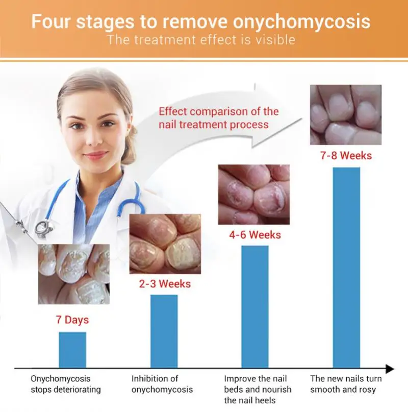 Эссенция для восстановления ногтей от грибков сыворотка ухода лечение ногтевого