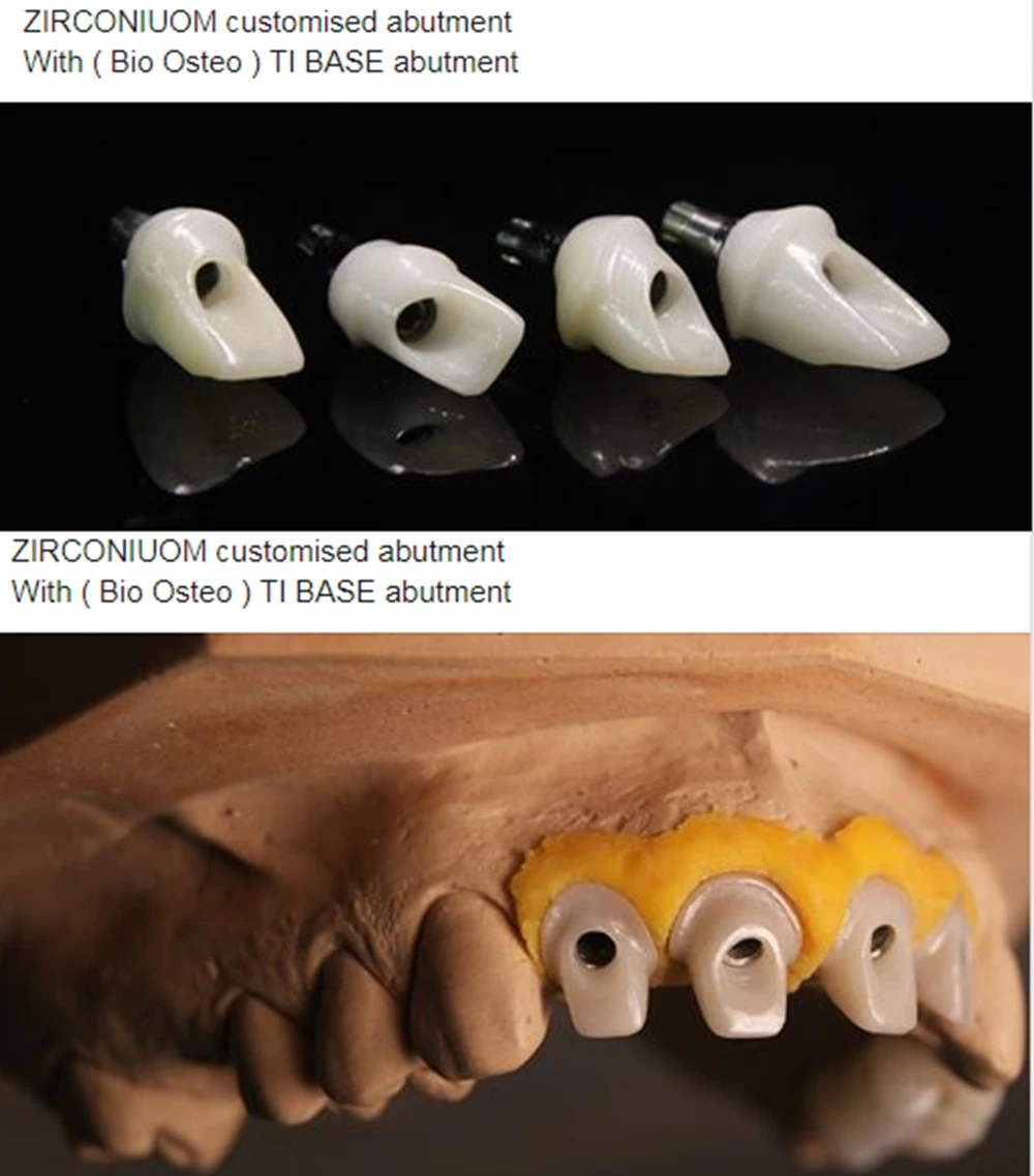 

Monolithi Zirconia Ceramic Disc HT Dental Lab Cadcam Materials For Zirkonzahn Amann Girrbach Roland Wieland Imes Icore VHF