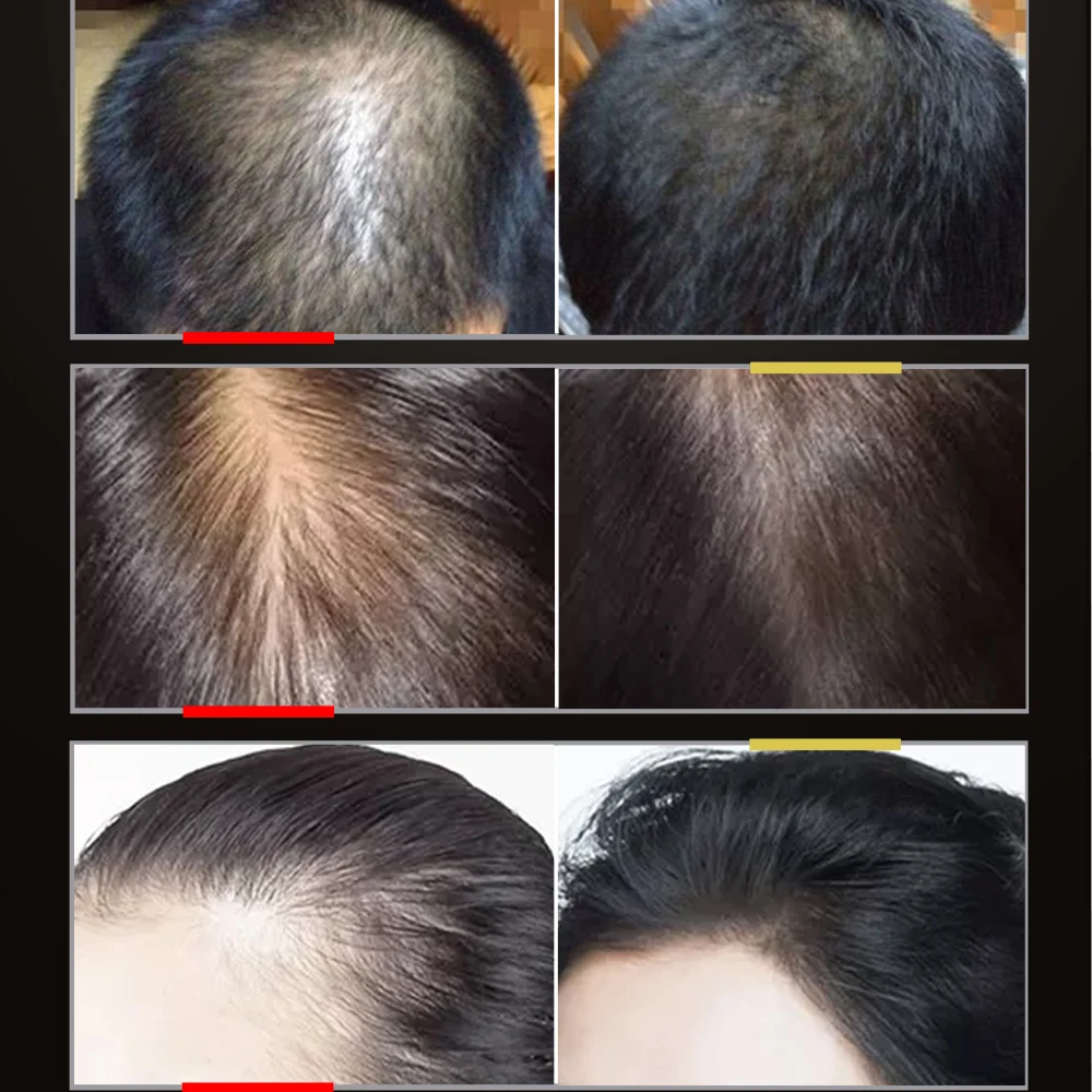 

30ML Hair Growth Essential Oil Hair Care Essential Oil Dry Damaged Hairs Nutrition Hair Growth