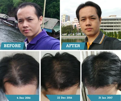 Лосьон для волос с питательными веществами корней 120 мл|Уход за волосами и кожей