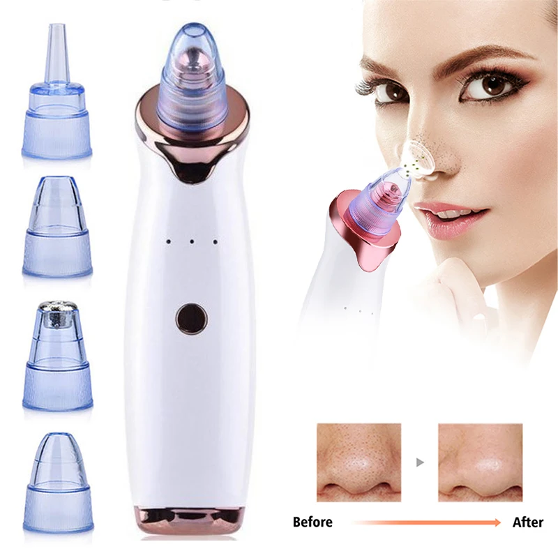 

Пылесос машина для удаления черных точек на коже и пор экстрактор для удаления черных точек очищающий нос для лица акне черная головка для о...