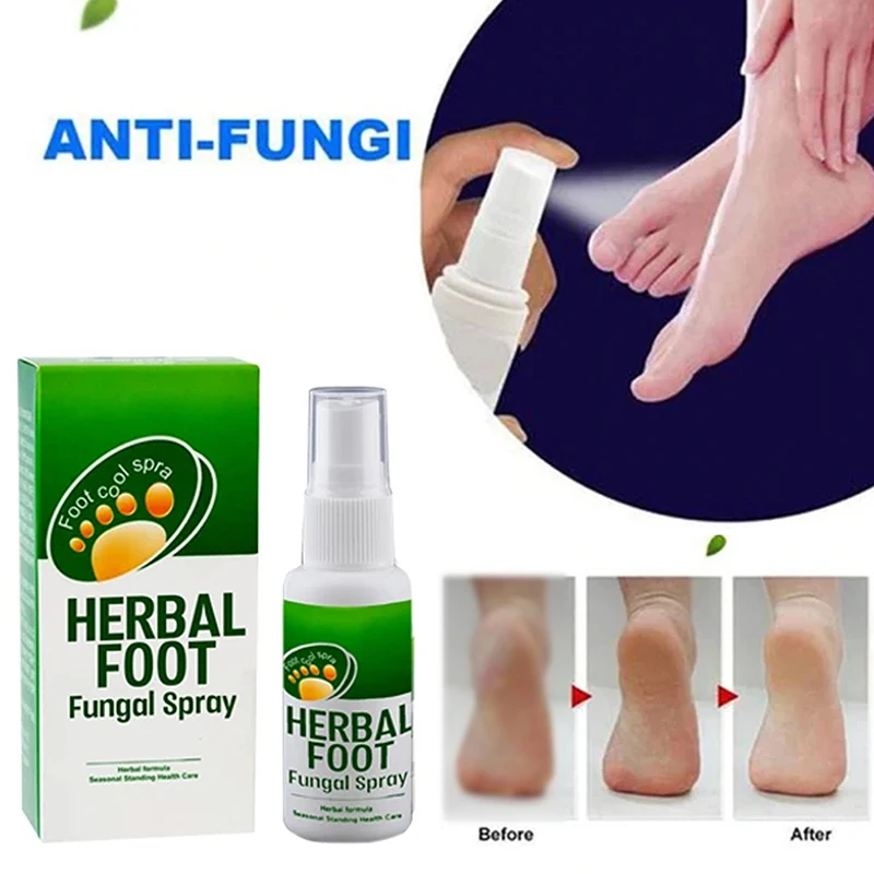 

30ml Herbal Foot Treatment Anti-fungal Infections Onychomycosis Paronychia Effective Toe Fungus Treatment Foot Care