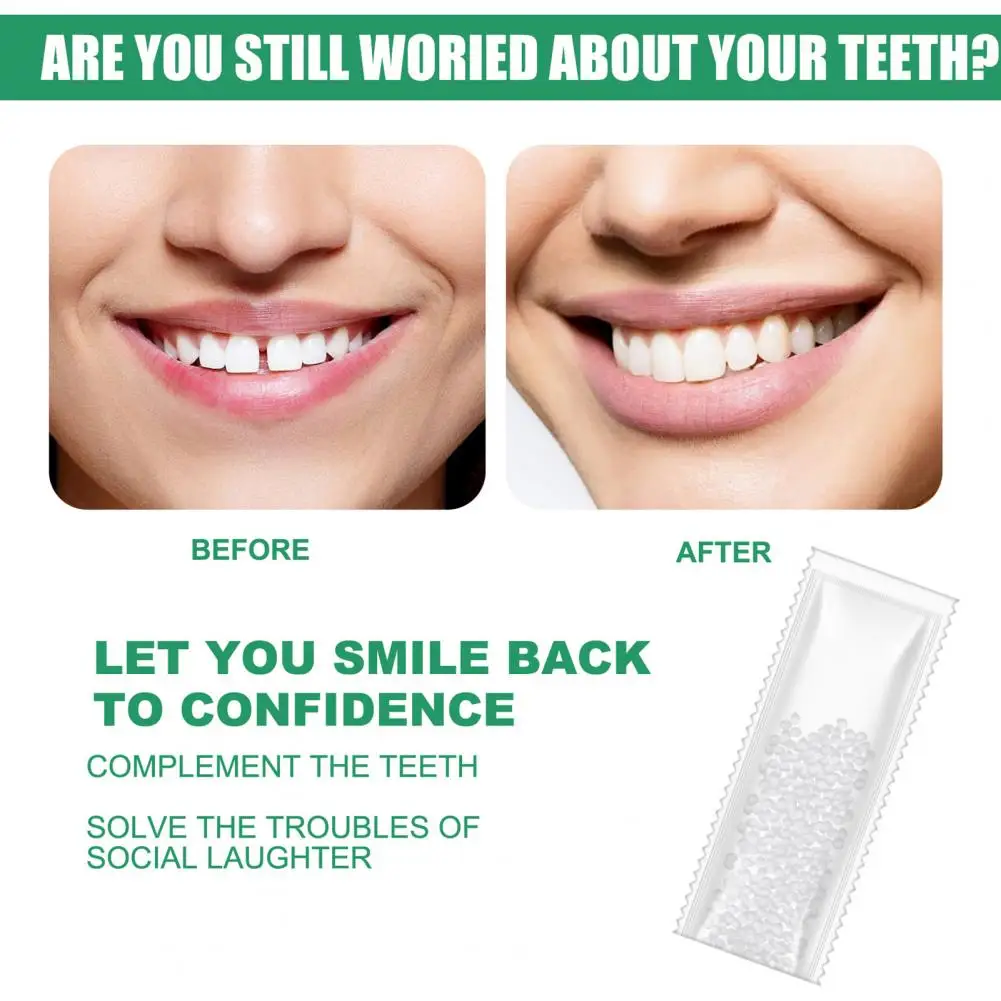

25/50/100g Temporary Tooth Replacement Material Tooth Filling Solid Glue Temp Replace Missing Denture DIY Teeth Repair Dental