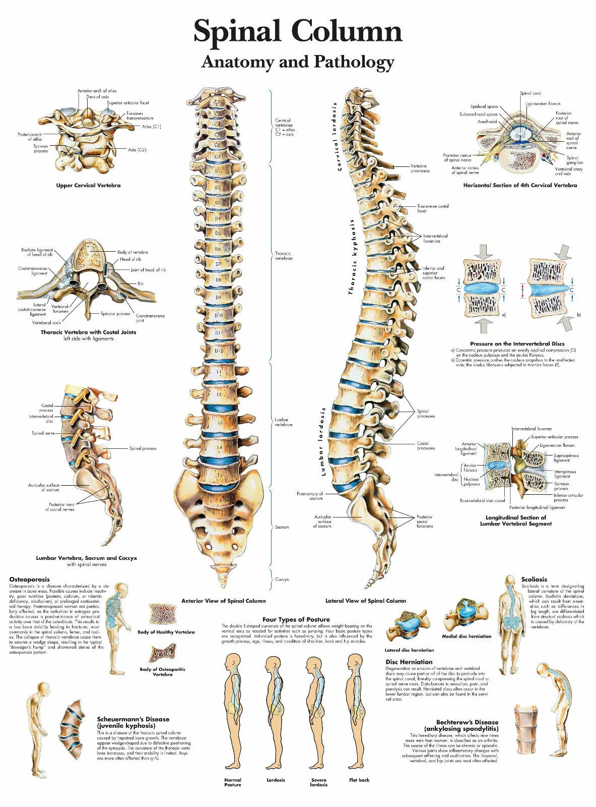 

The Human Spinal Column (Text Book Anatomy Picture Doctor) Art Silk Poster Print 24x36inch