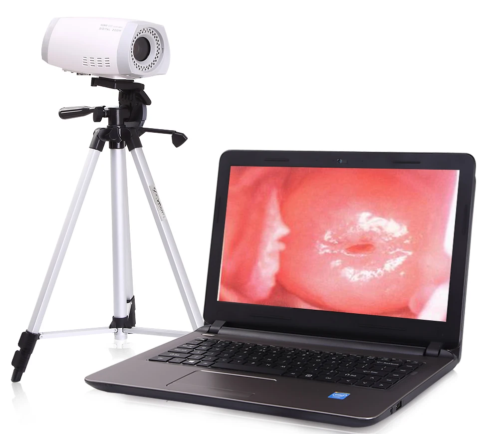 Digital Surgical gynecological colposcopy machine equipment set with camera colposcopy instruments