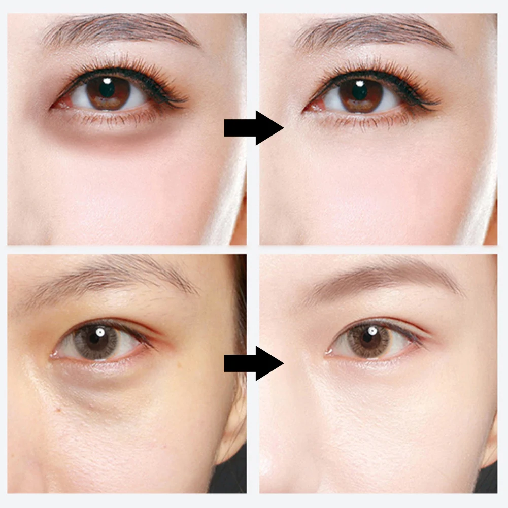 

60 Pcs Crystal Gold Eye Mask Collagen Anti Aging Whitening Remove Wrinkles Dark Circles Acne Beauty Patches For Eye Skin Care