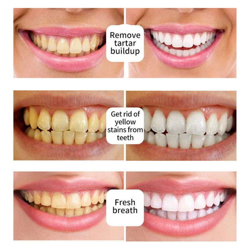3 мл отбеливающая ручка для зубов Очищающая сыворотка удаляет зубные пятна