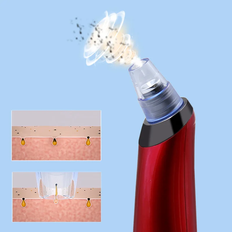 Face Skin Care Machine Nose Acne Cleanup Cleansing Electric Vacuum Cleaner Pore Blackhead Cleaning Kit Blemish Removers | Красота и