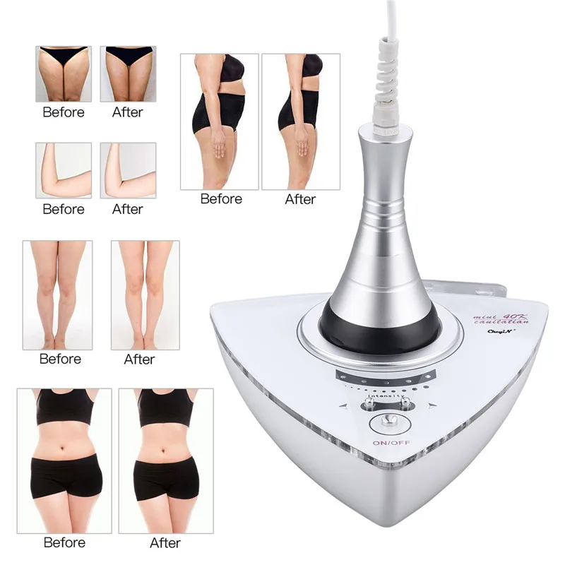 

CkeyiN 40K Ultrasonic Cavitation Body Shaping Machine Tighten Skin Weight Loss Body Lifting Firming Anti aging Fat Burning Tool