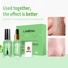 Средство LANBENA для ухода за кожей с зеленым чаем, маска для удаления черных точек, маска для носа, полоска для пилинга пор, лечение акне, сыворотка для минимизации пор