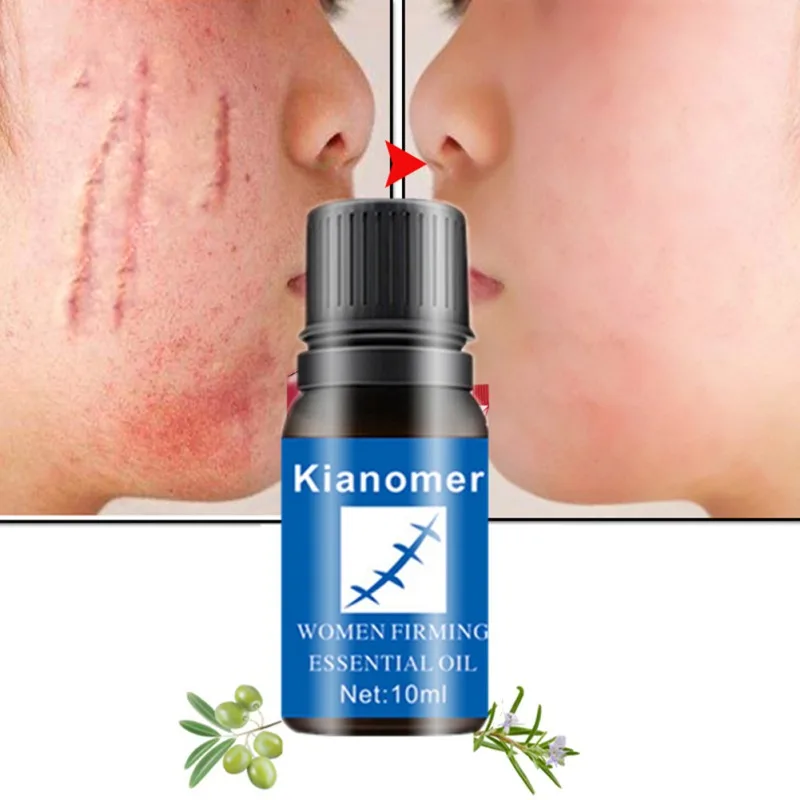 

Scars Removal Oil Nourishing Skin Lightening Pigment Acne Marks Scars Remover Creams & Moisturizers