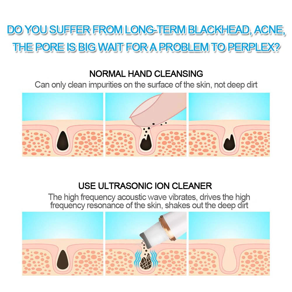 Facial Skin Scrubber Blackhead Remover Ultrasonic Face Deep Pore Acne Cleaner Spatula Face Lifting Whitening Massager Skin Care