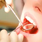 Стальной стоматологический инструмент для удаления зубного расчёса и Тартара, зубной инструмент для очистки и ухода за зубами, профессиональное зеркало