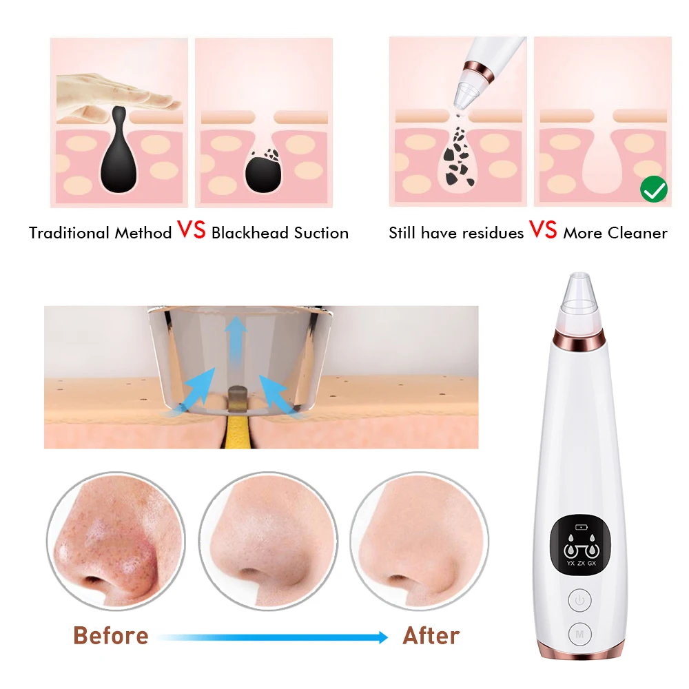 

Blackhead Remover Vacuum Pore Cleaner Electric Nose Face Deep Cleansing Skin Care Machine Birthday Gift Dropshipping Beauty Tool