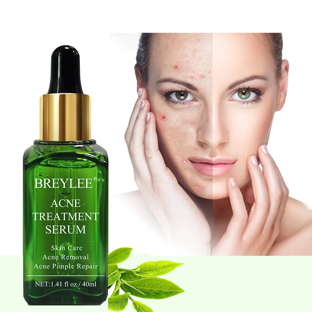 

Acne Treatment Serum Whitening Moisturizing Oil Control Remove Pimple Shrink Pores Repair Damaged Skin Soothing Acne Face Care