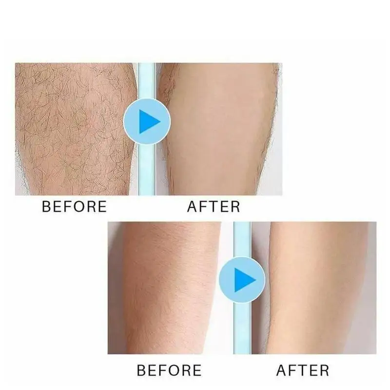 

Hair Removal Clean Gel lubricant Hair Removal Spray Treatment Liquid Hair Removal Waxing Spray Hair Removal Clean Care Spray