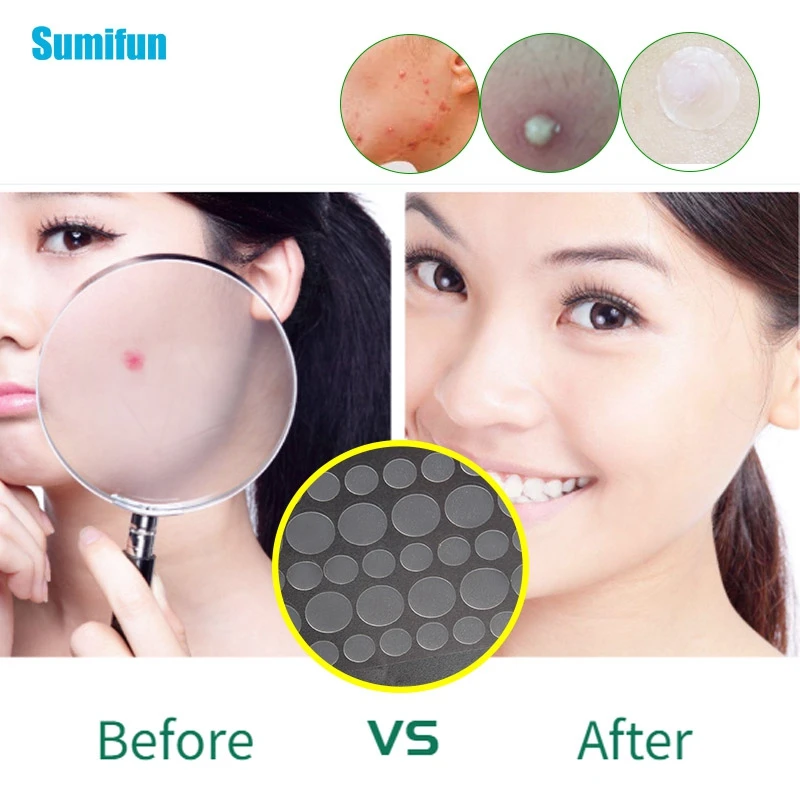 36 шт./1 мешок патчи от акне Гидроколлоидные прыщи точки невидимое точечное