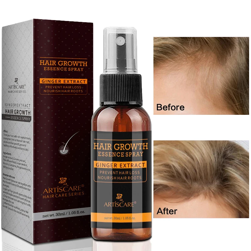 

Hair Growth Essence Spray Hair Care Repair Nourish Anti-Hair Loss Thick And Supple Oil Control Anti-Dandruff Scalp care 30ml