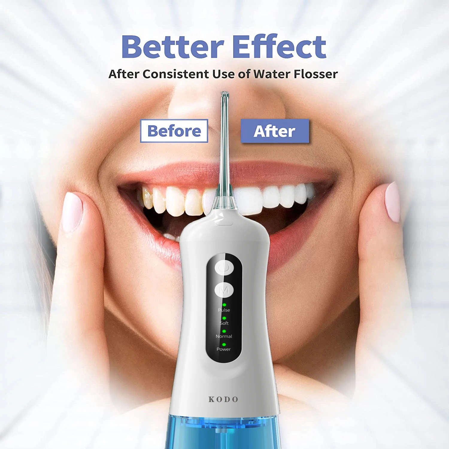 KODO Oral Irrigator  for teeth Water Flosser USB Rechargeable Portable Dental Water Jet 300ML irrigador dental dental floss enlarge