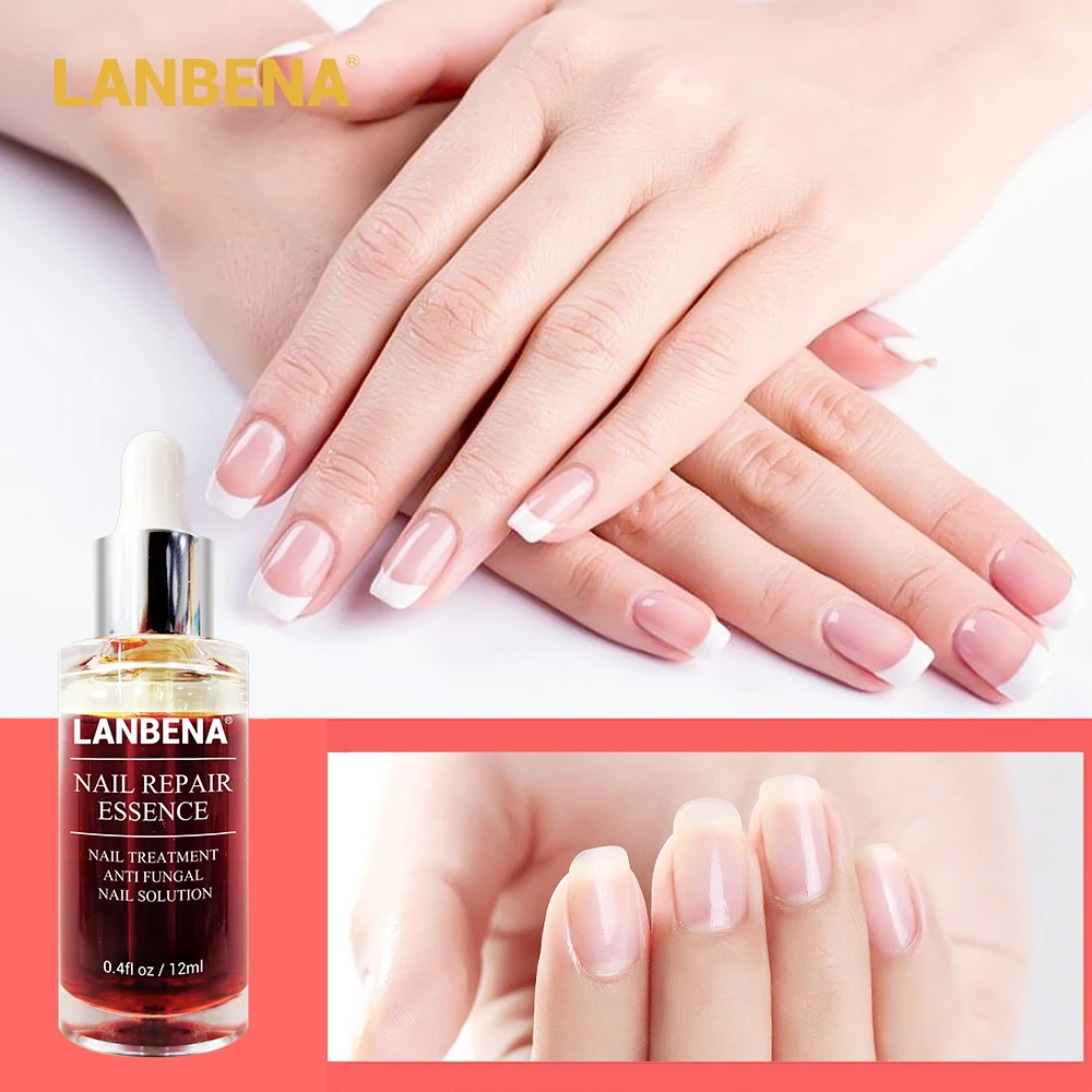 LANBENA, сыворотка для восстановления ногтей, лечение грибковых ногтей, эссенция для удаления онихомикоза, для пальцев ног, Питательная, осветляющая, уход за кожей