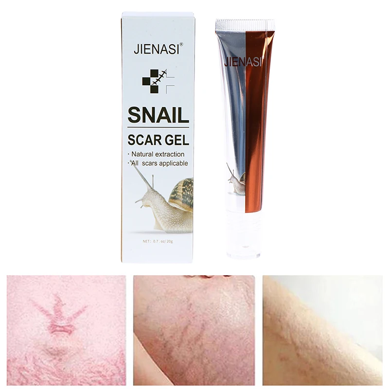 

Acne Scar Removal Cream Gel Stretch Marks Cream Repairing Smoothing Whitening scar gel