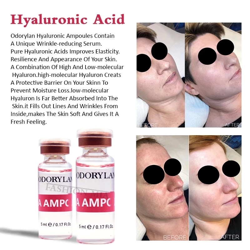 5ML/Bottle Hyaluronic Acid Mesotherapy Face Beauty HA for Wrinkle Ance Remove Serum Ampoule Whitening Hylaronic Skin Care - купить по