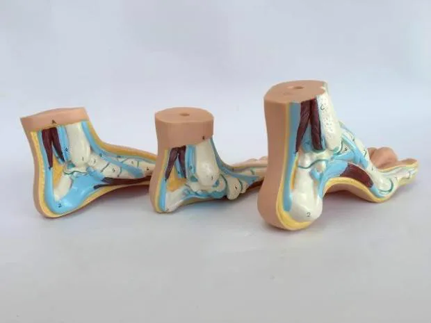 

3pcs/set Medical Anatomy Human Foot Normal Foot Flat and Arched Foot Anatomy Model Human Sketelon Model Flat High Arched Feet