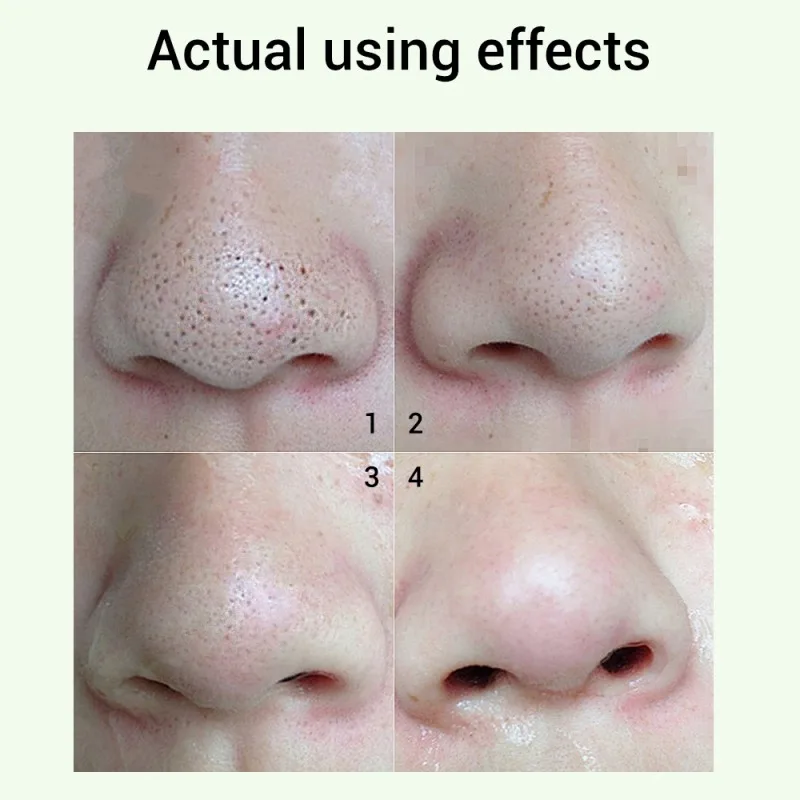 

Shrink Pores Tightens Skin Care Essence Pore Refining Serum Moisturizing Whitening Anti-aging Oil Control Essence