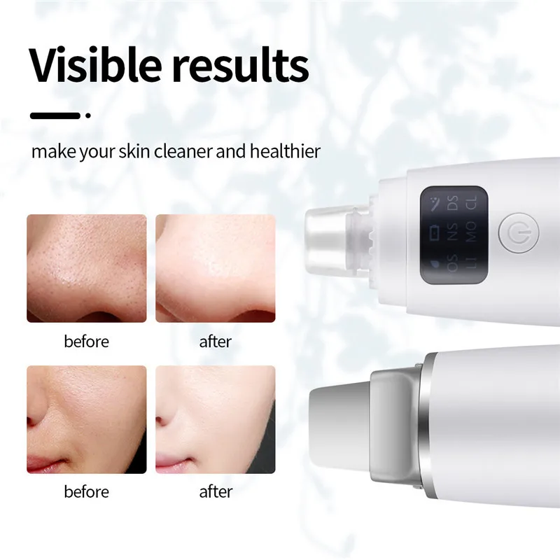 

CkeyiN Electric Facial Deep Cleaning Brush Ultrasonic Vibration Skin Scrubber Blackhead Removal Face Washing Silicone Cleanser