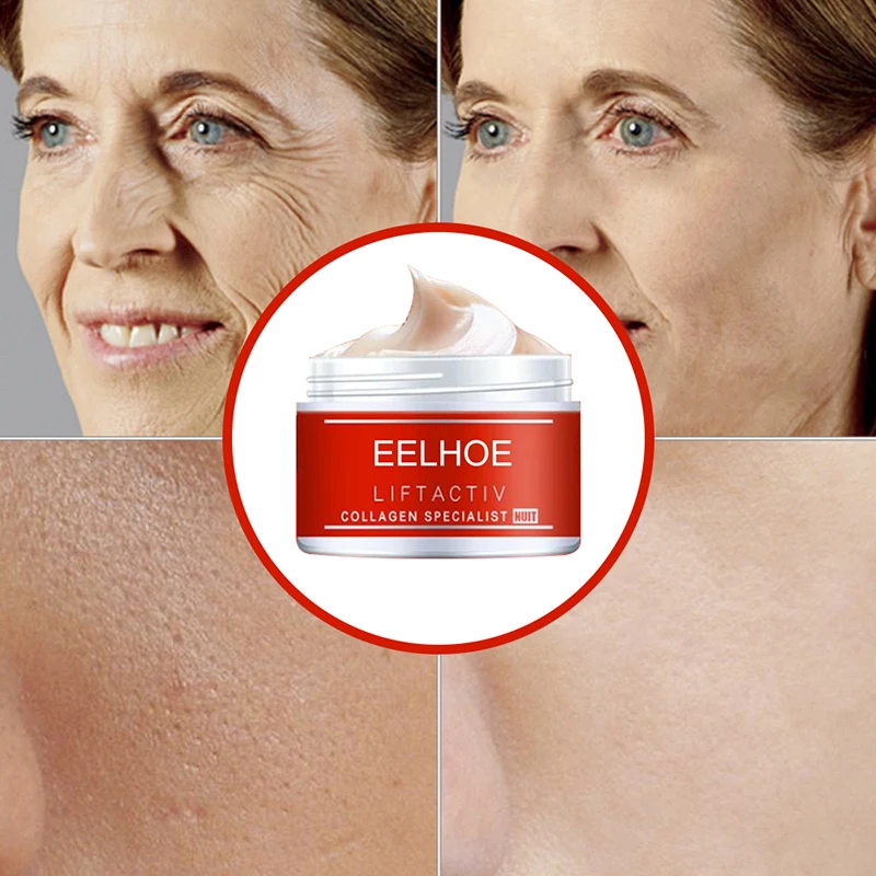 Moisturizing Freckle Removal Cream Anti-wrinkle Anti Aging Whitening Pregnant Spots Melanin Dark |
