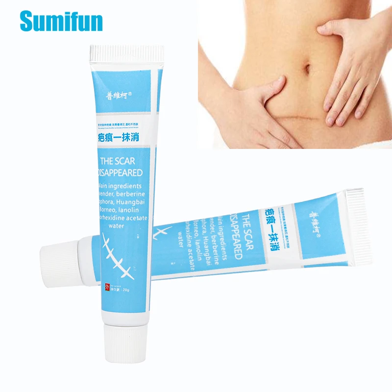 1/2 шт. мазь для удаления шрамов от акне | Красота и здоровье