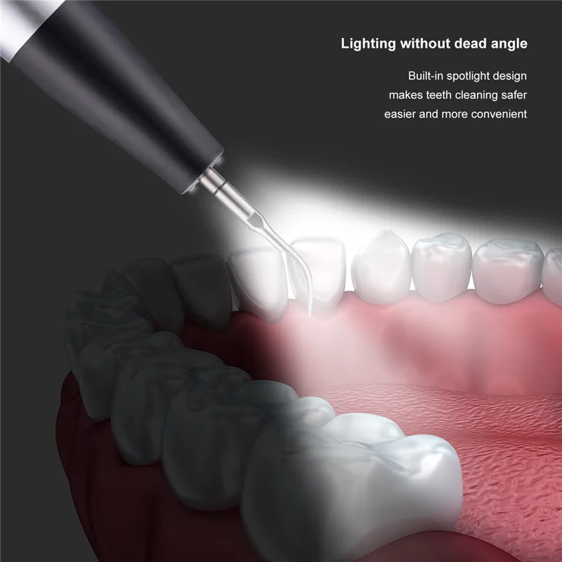 

CkeyiN Ultrasonic Dental Scaler High-frequency Vibration Ion Tooth Calculus Remover Kit Tartar Teeth Whitening Oral Care Tool