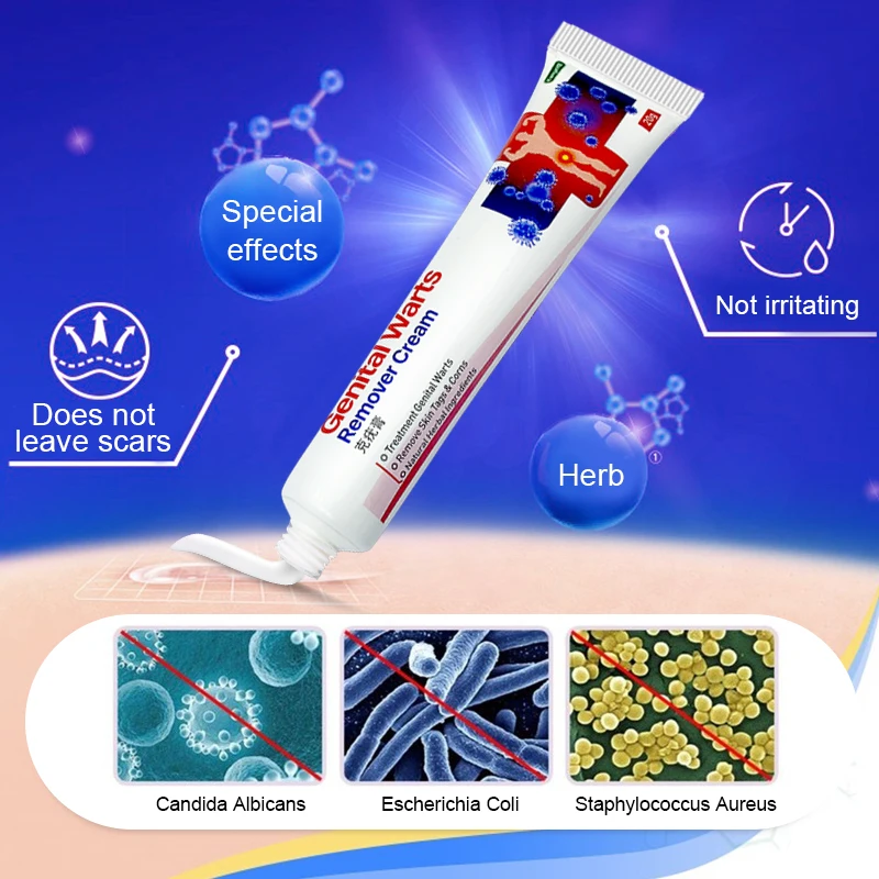 1pcs Wart Remover Cream Skin Tags Mole &amp Papillomas Treatment Private Parts Genital Antibacterial Ointment G006 | Красота и
