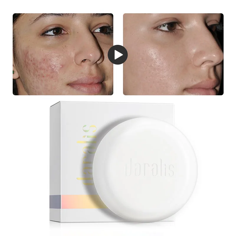 Daralis 100 г Удаление прыщей поры акне шелк фиброин мыло маска для лица козье молоко