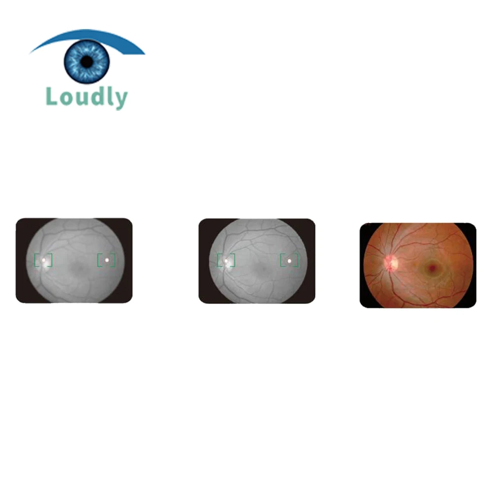 Китай лучшее качество оптические инструменты Настольный fundus камера APS