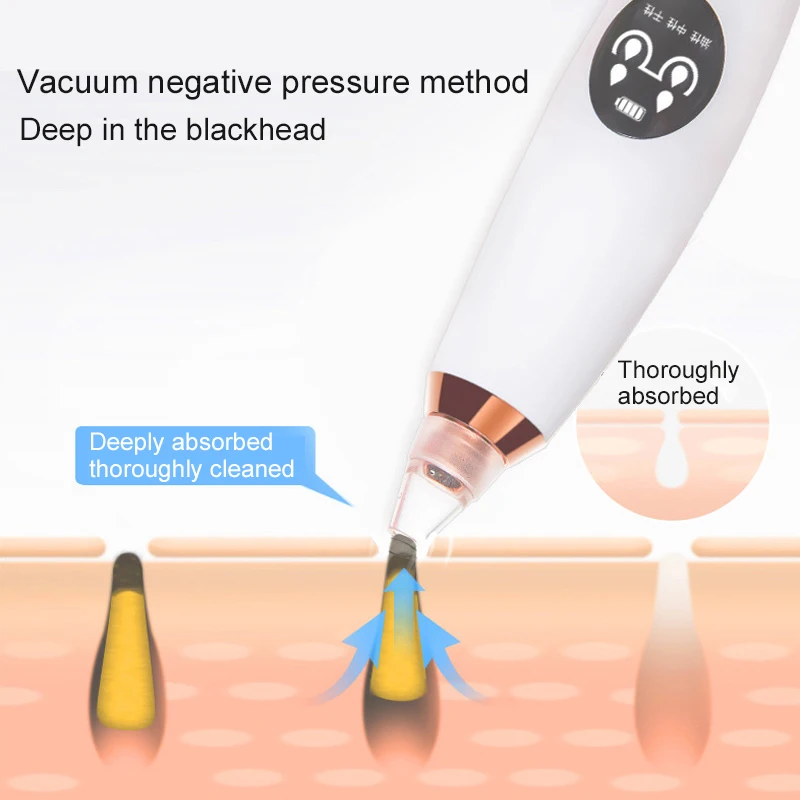 от прыщей для лица Черное очищающее средство черных точек аппарат Электрический