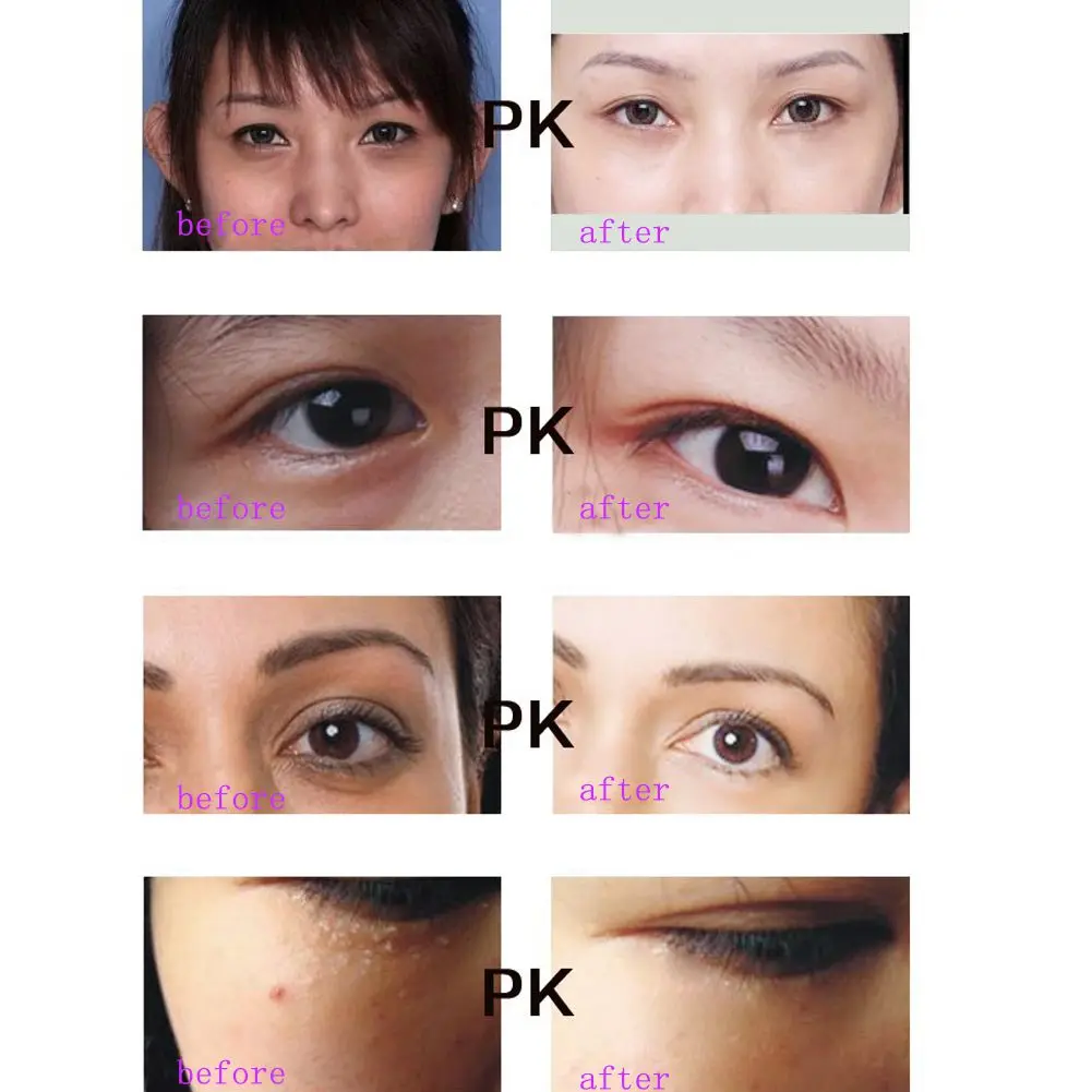 Крем для кожи вокруг глаз от морщин припухлости улиток |