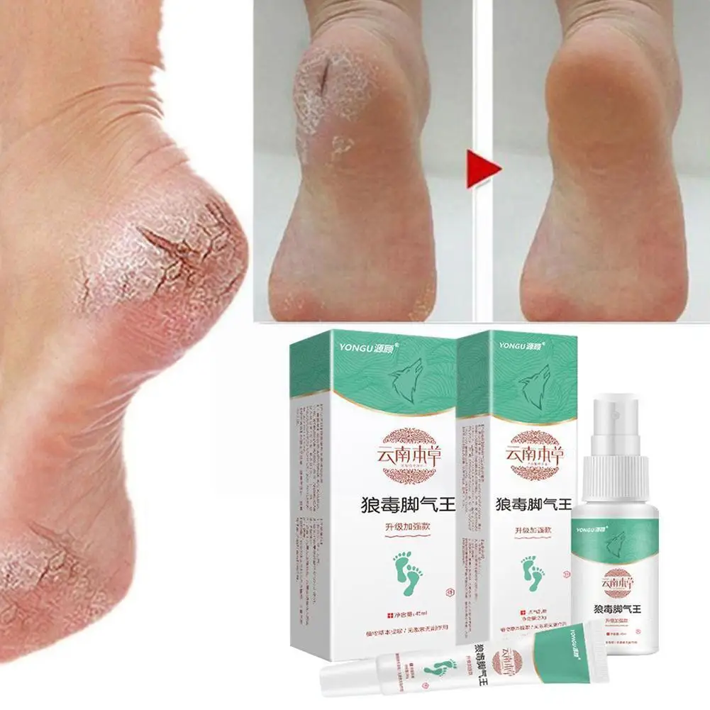 

Уход за ногами спрей травяной спрей для ног лечение ног спрей растительный спрей для трав Свежий бактериостатический антибактериальный де...