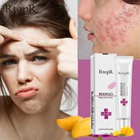 acne treatment face cream blackhead repair gel oil control shrink pores scar whitening moisturizer skin care korean cosmetics