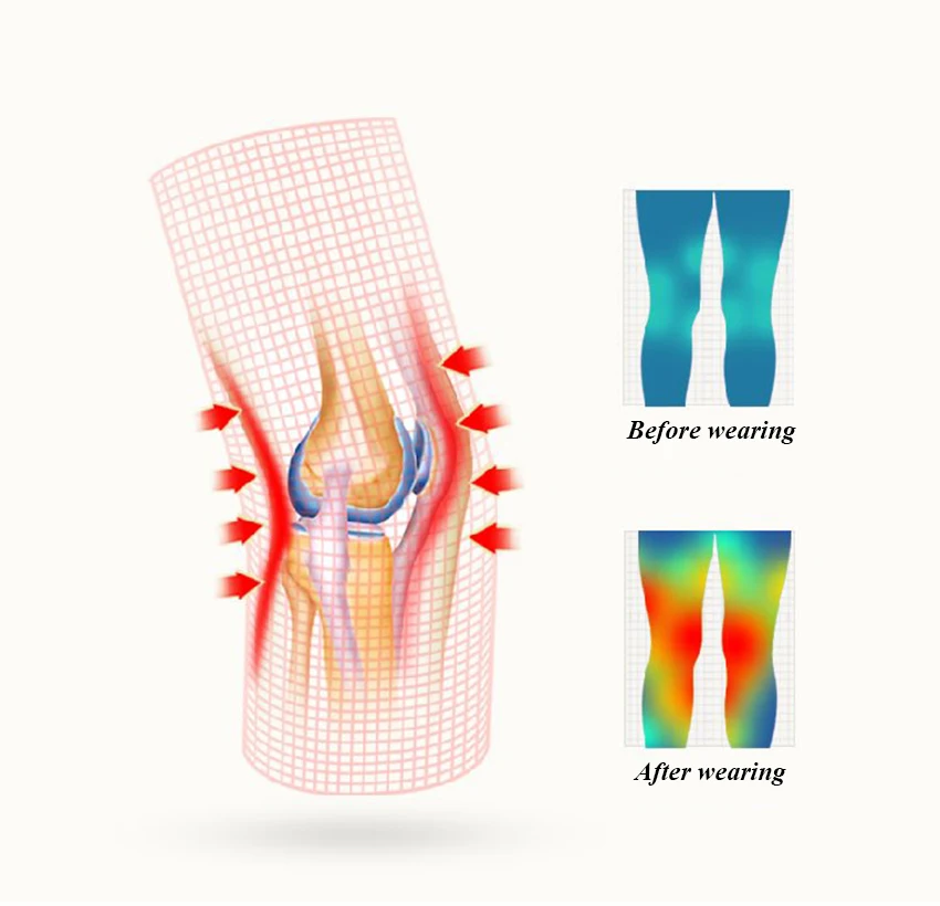 Jual Perawatan Kesehatan 1 Pasang Pemanas Listrik Bantalan Lutut Moksibusi Terapi Kompres Panas Rematik Arthritis 220V 100W Tempera Dapat Disesuaikan