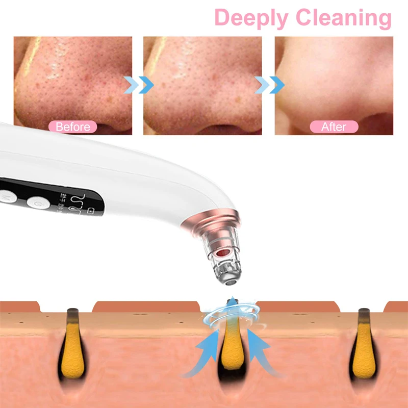 

Vacuum Blackhead Remover Acne Suction Pore Vacuum Skin Care Tools Face Nose Deep Cleaners USB Electric Black Head Suker Removal