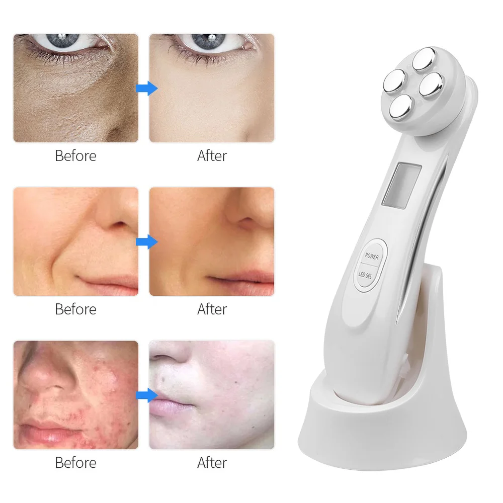 

5 In1 RF EMS Electroporation Led Photon Light Therapy Beauty Device Anti Aging Face Lifting Tightening Eye Care Facial Massager